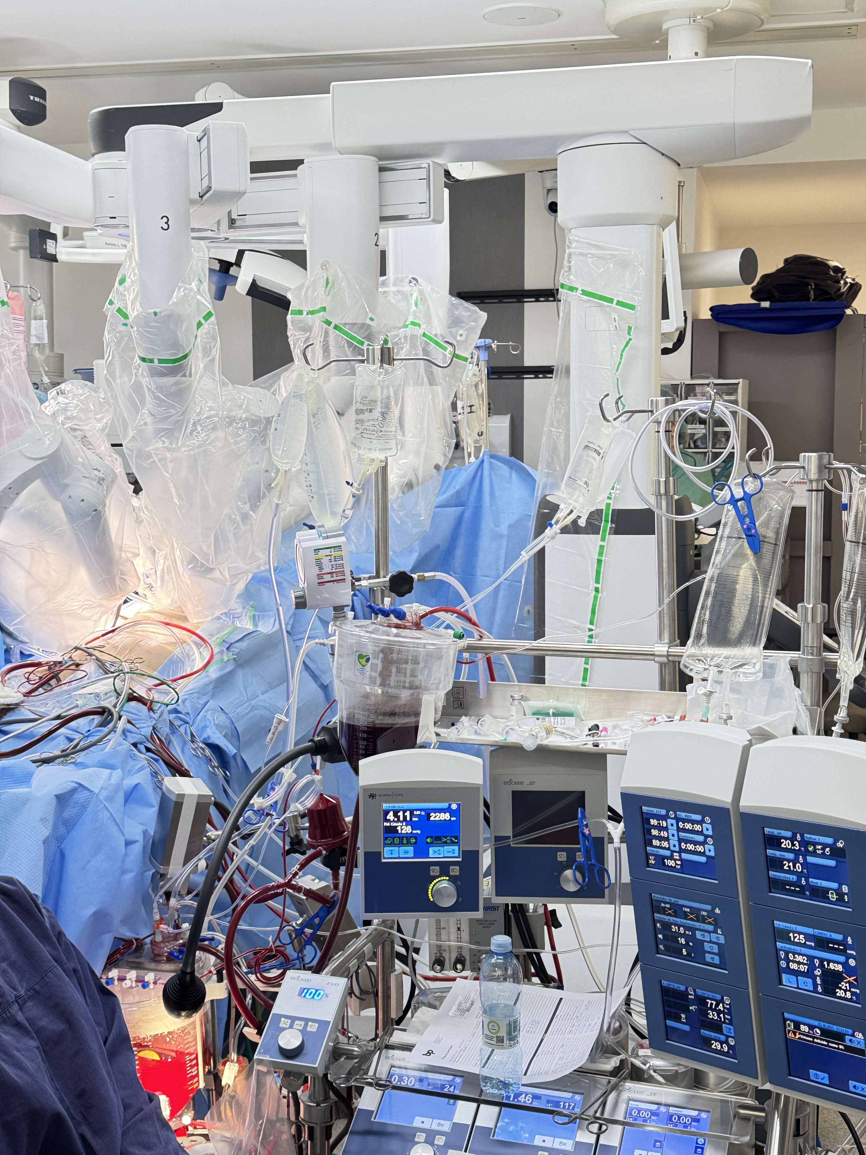 Cirurgia robótica em andamento